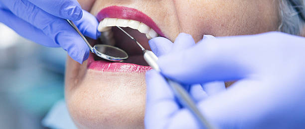 Best Emergency Dentist for Lost Fillings or Crowns in St Jaco, IL